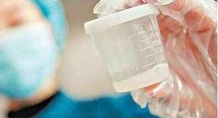 皇家生殖试管技术如何提高胚胎质量？