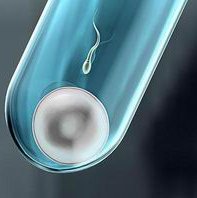 申请卵子助孕时的子宫状况分析，高龄如何调节子宫提升成功率