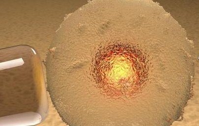 想要做试管婴儿基因筛查对优生优育有多重要？